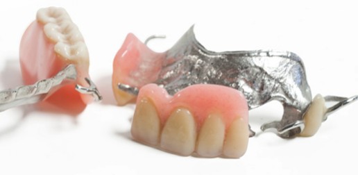 Remplacement de dents manquantes - Prothèses partielles amovibles